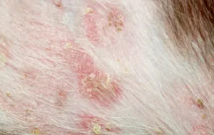 Adenoviroz okok, tünetek, kezelés (adenoviroz) Adenoviroz okok, tünetek, kezelés