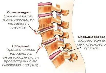 Какви са причините и какво да направите, ако възпалено врата на главата (врата) Какви са причините и какво да направите, ако главата болки в шията