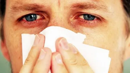 Allergiás a sör - Tünetek, fotó allergiás reakciók felnőtteknél