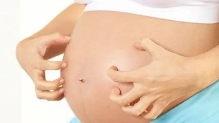 Allergiás a csípésével poloska okok, tünetek, kezelés (poloskák) Allergiás a csípésével poloska okok, tünetek, kezelés