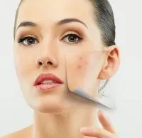 Как да се грижим за мазна кожа на лицето съвети, рецепти
