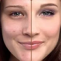 Как да се грижим за мазна кожа на лицето съвети, рецепти