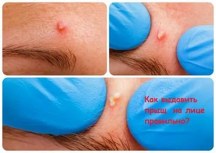 Как да прокара пъпка няма вредни въздействия