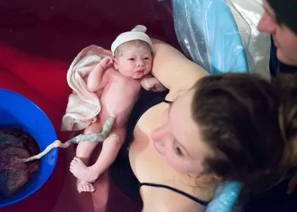 Какво е раждането на дете преди раждането снимка, снимка след раждането след цезарово сечение снимка, снимка