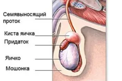 Нематода тестисите причини за мъжки, симптоми, лечение