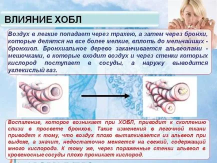 кашлица на пушачите как да се отървете от симптомите