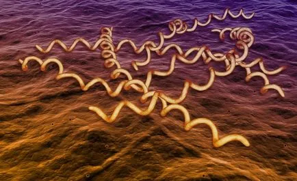 Antitestek Treponema pallidum - ez