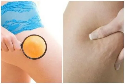 Anti-cellulit helicons legjobb márka leküzdésére cellulit (narancsbőr elleni gél legjobb márka leküzdésére cellulit badyaga plusz moszat Oriflame Pure vonal Black Pearl Photo Video útmutató) Anti-cellulit helicons legjobb márka a harcot a narancsbőr