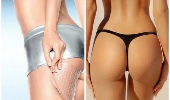 Anti-cellulit helicons legjobb márka leküzdésére cellulit (narancsbőr elleni gél legjobb márka leküzdésére cellulit badyaga plusz moszat Oriflame Pure vonal Black Pearl Photo Video útmutató) Anti-cellulit helicons legjobb márka a harcot a narancsbőr