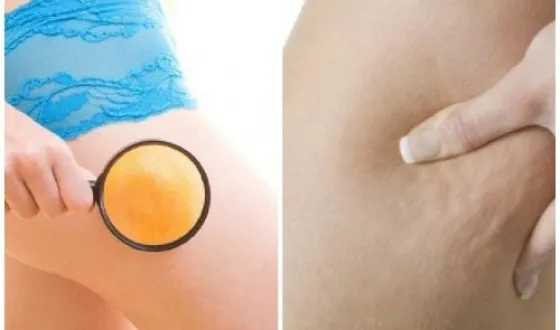Anti-cellulit helicons legjobb márka leküzdésére cellulit ( „Badyaga plusz moszat”) Anti-cellulit helicons legjobb márka a harcot a narancsbőr
