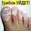 лечение гъбички Оцет