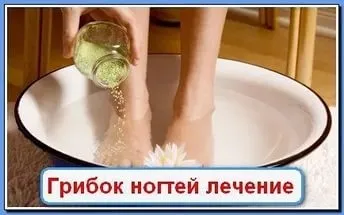 Повечето ефективни национални методи за лечение на гъбички на ноктите