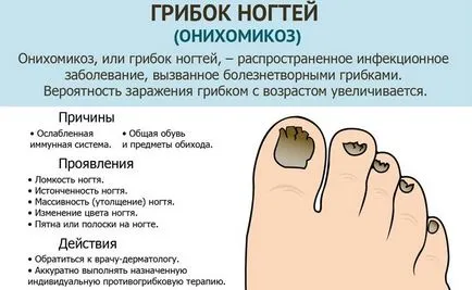 Повечето ефективни национални методи за лечение на гъбички на ноктите