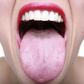 Tongue покритие бял цвят причини и как да го премахнете