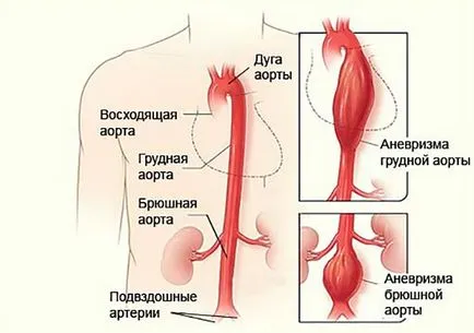 коремна MRI какво е, кои органи да проверят