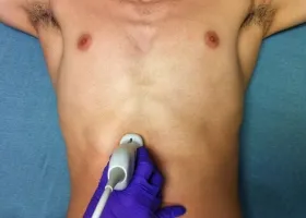 Sick след хранене причини и какво да правя