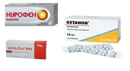 Fogfájás után caries kezelés - kezelés a kiváltó okok és a