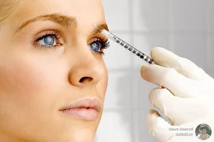 Botox arc válaszokat és az esetleges negatív következményeket (negatív) Botox arc válaszokat és az esetleges negatív következmények