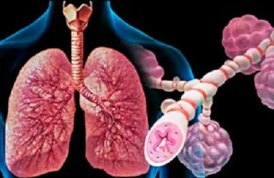 Бронхоспазъм при деца cimptomy и лечение, отколкото да се оттегли, наркотици и спешна медицинска помощ (деца) Cimptomy бронхоспазъм при деца и лечение, отколкото да се оттегли, лекарства и първа помощ