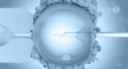 Еко различава от ICSI и има ли разлика в протоколите