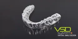 Какви са aligners