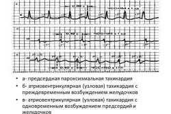 A veszélyes tachycardia hatások és szövődmények