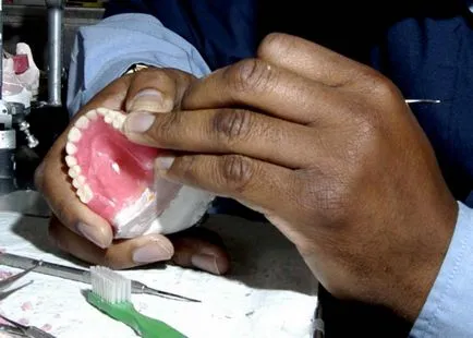 Mit jelent a fogtechnikus, hogyan lesz egy szakértő ezen a területen (technikus) Mit jelent a fogtechnikus, hogyan lesz egy szakértő ezen a területen