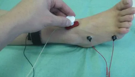Electroneuromyographic какво е electroneuromyography лицето и крайниците