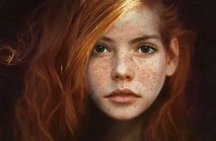 хиперпигментация на кожата - причини, видове и методи за лечение,