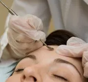 Ботоксът Botox е вредно за лице (последиците)