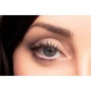 Ботоксът Botox е вредно за лице (последиците)