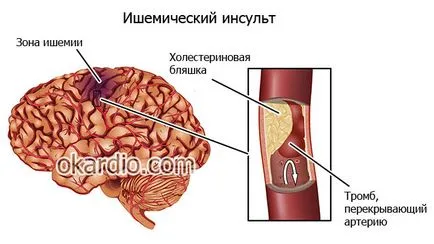 ACE списък лекарства инхибитори, какво е това, показанията на тяхната ефективност