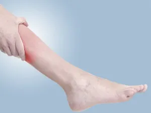 Mi a teendő, ha kificamodott láb