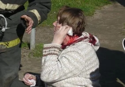 Mi a teendő baleset esetén