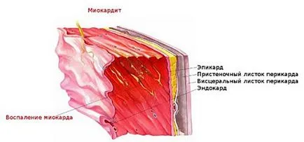 Как сърцето боли симптоми и признаци