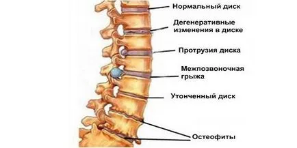 Как сърцето боли симптоми и признаци