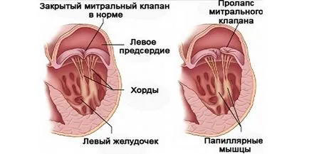 Как сърцето боли симптоми и признаци