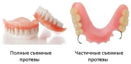 Какви са поставени зъби - дали да вмъкнете зъби болка и колко струва - Стоматологичен портал