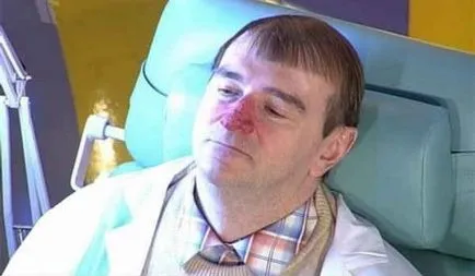 Как се лекува розацея