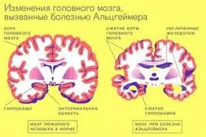 Както гръбначния мозък се формира от сиво вещество от медулата и вторични, където е едновременно