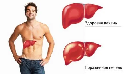 Как да определите хепатит и форми и форми на заболяването, как да проверите