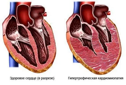 Как да се обучават сърцето 1