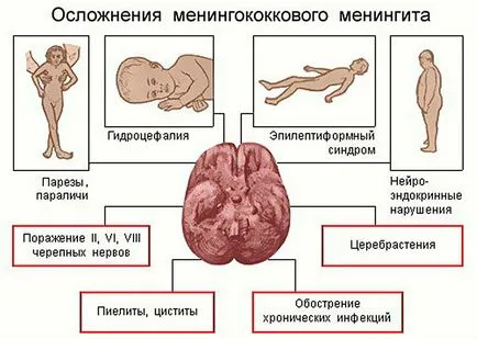 Mi az ökológiai agykárosodás, a tünetek és okait (szerves) Mi az ökológiai agykárosodás, a tünetek és okok