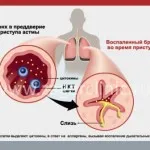 Кашлица през нощта при възрастните причинява от нощна кашлица