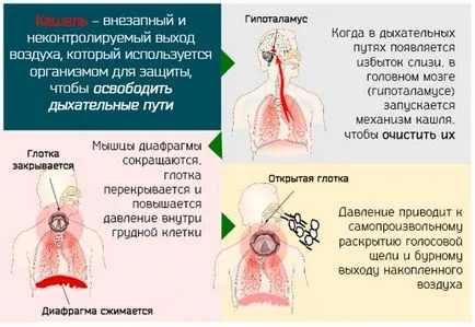 видове Кашлица, причини, симптоми, как да се лекува, отколкото да се лекува
