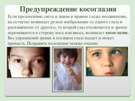 лечение кривогледство при възрастни - видове, причини и лечение