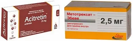 Палмоплантарис псориазис образ, лечение на народната медицина (палмоплантарис) Палмоплантарис псориазис картина, лечение на народната медицина