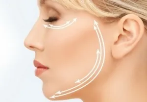 Mi az rf-facelift és akinek ez valóban szükséges (RF facelift ellenjavallatok) Mi az rf-facelift, és aki valóban szüksége van