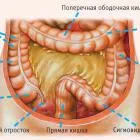 Лечение на основни заболявания на тънките черва