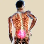 гръбначния херния лечение на народната медицина (10 упражнения рецепти)